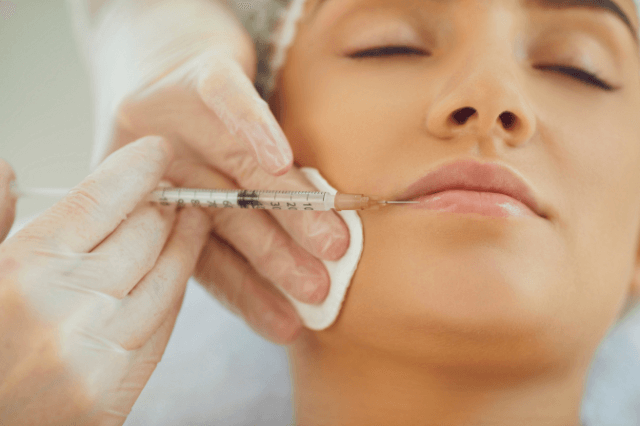 Lip Filler Treatment in Lucknow 

